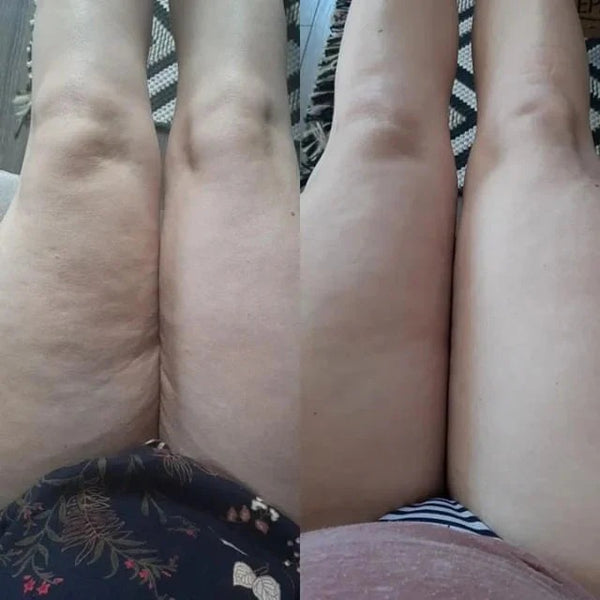 Gökçe Hanım 54 Yaşında