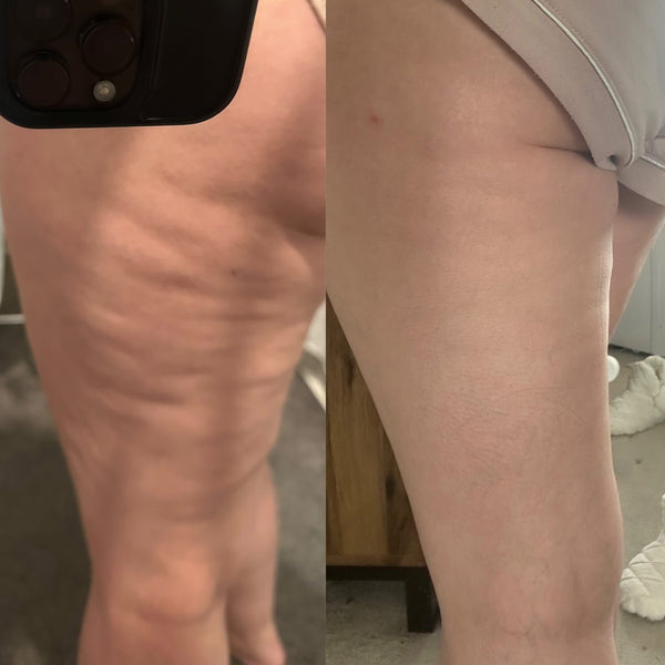 Zeynep Hanım 43 Yaşında